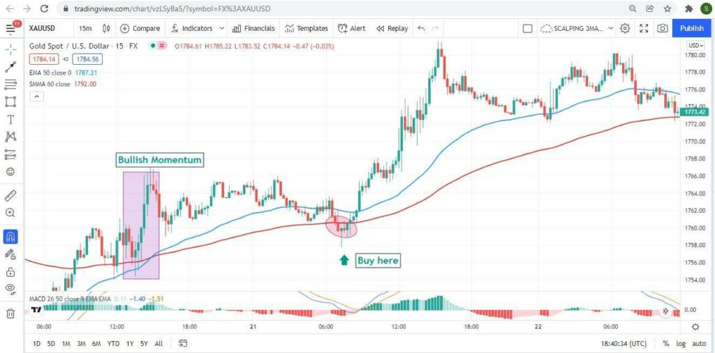 XAU/USD price chart